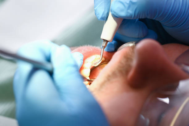 Best Chipped Tooth Repair Near Me  in Atlantic, IA