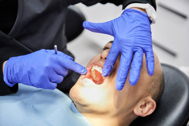 Best Chipped Tooth Repair Near Me  in Atlantic, IA