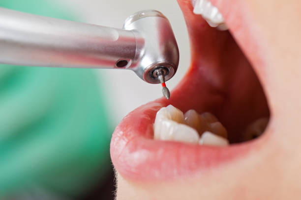 Emergency Gum Pain Relief in IA